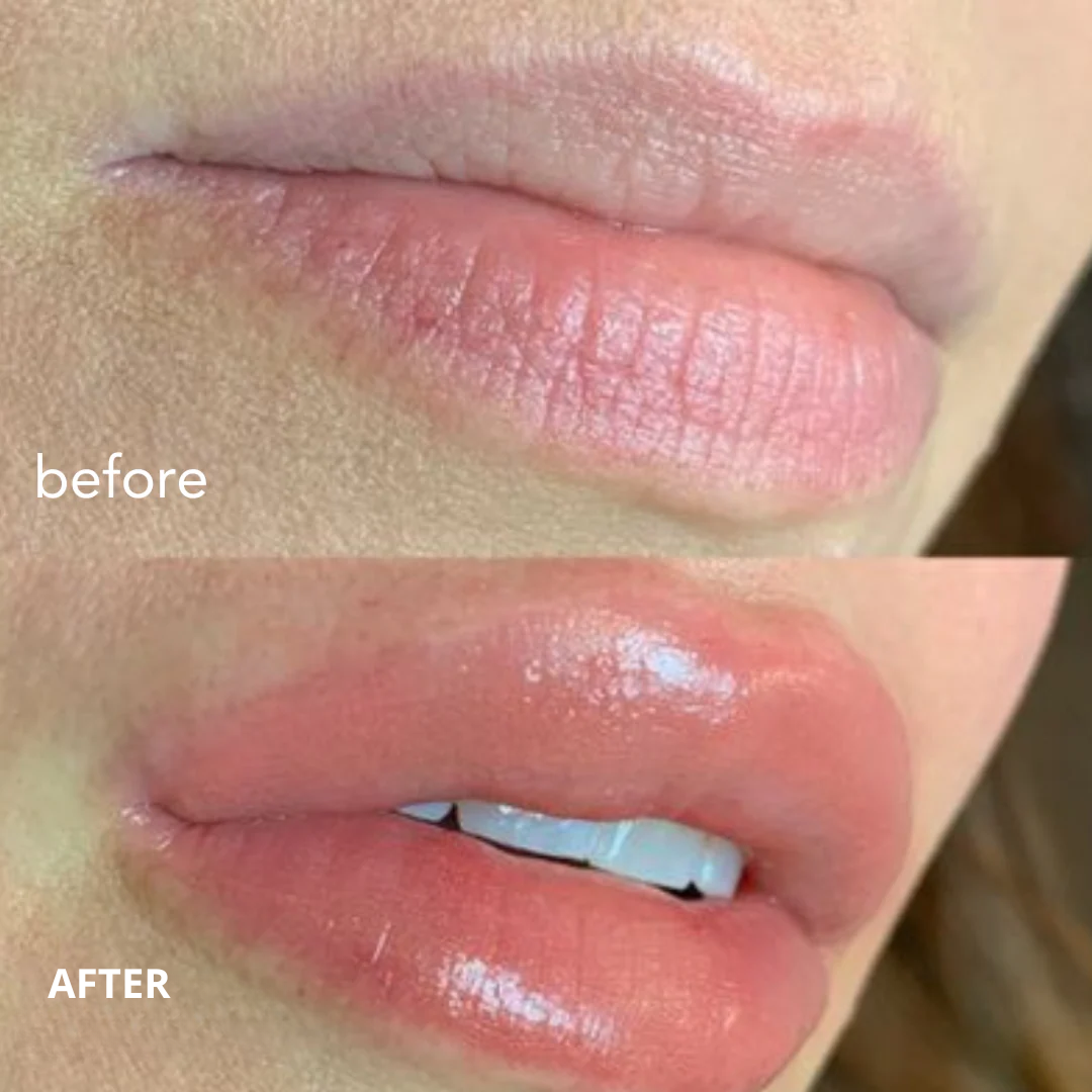 Extreme Lip Plumper 2