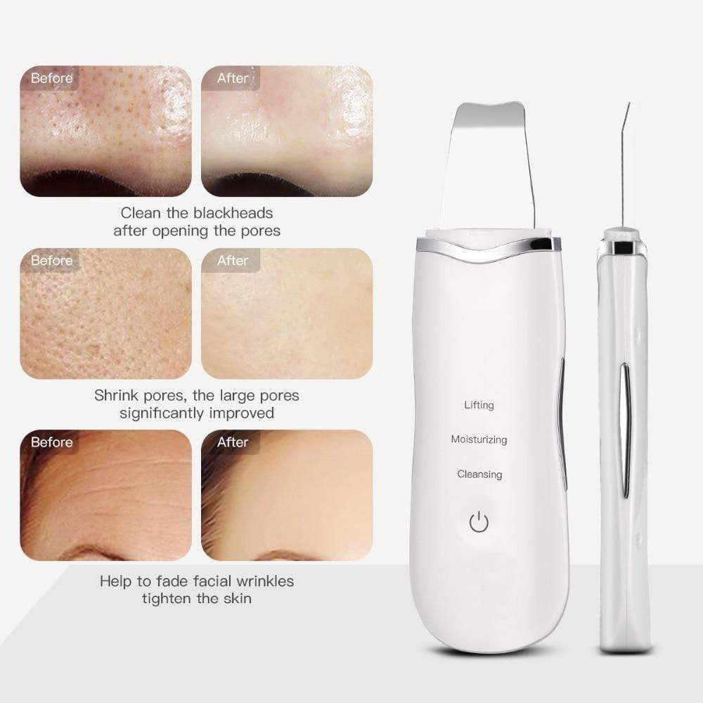 Zanzari GlowSonic™ – Diepe Gezichtsreiniger & Ultrasone Scrubber