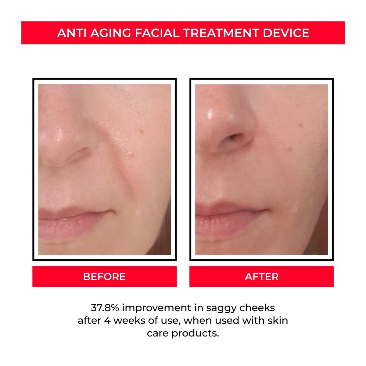 ANTI AGING SKIN TREAMENT PRO