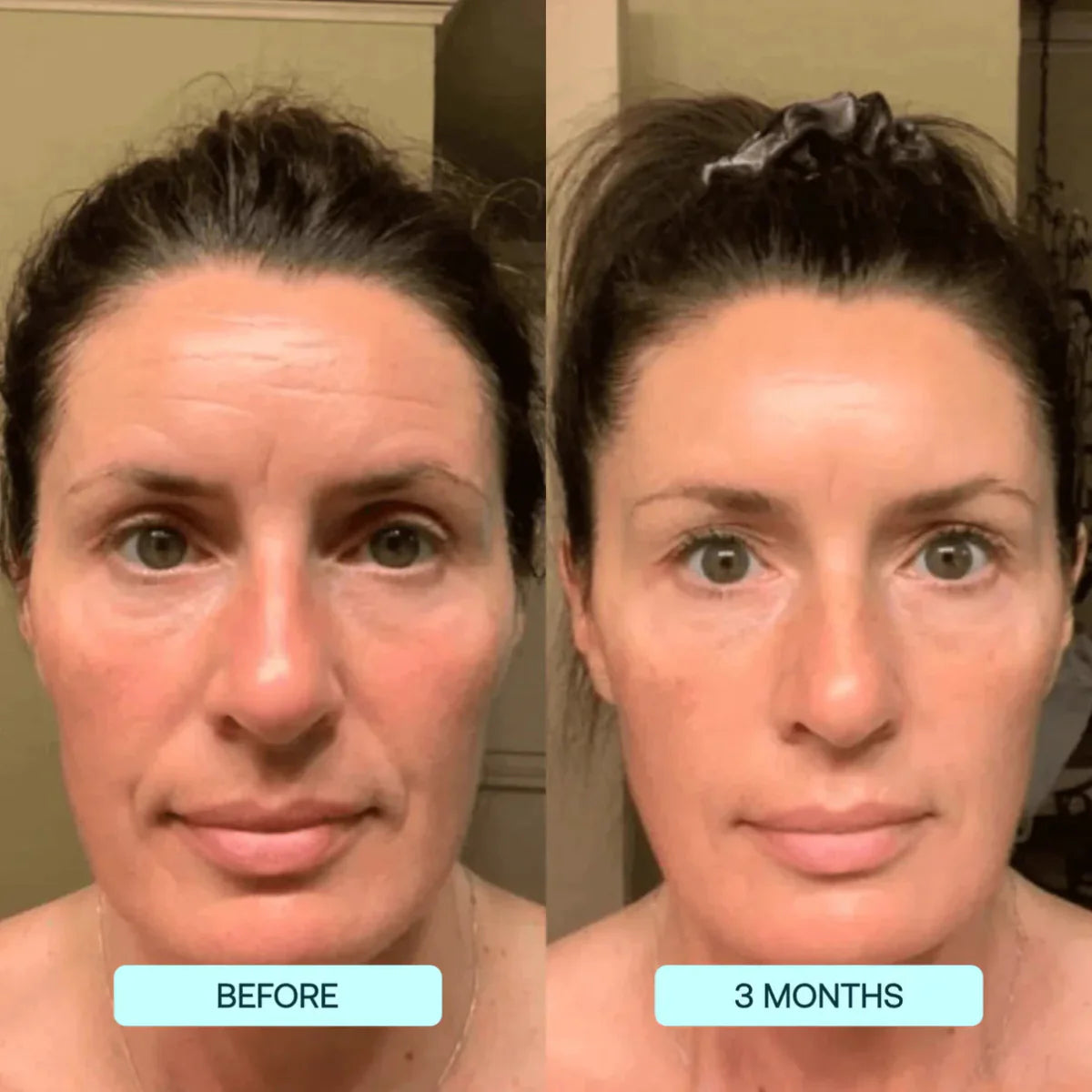 Zanzari Collageenfilms – NanoSkin™ Verstevigende Anti-Aging Boost