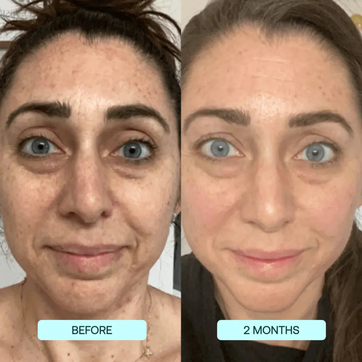 Zanzari Collageenfilms – NanoSkin™ Verstevigende Anti-Aging Boost
