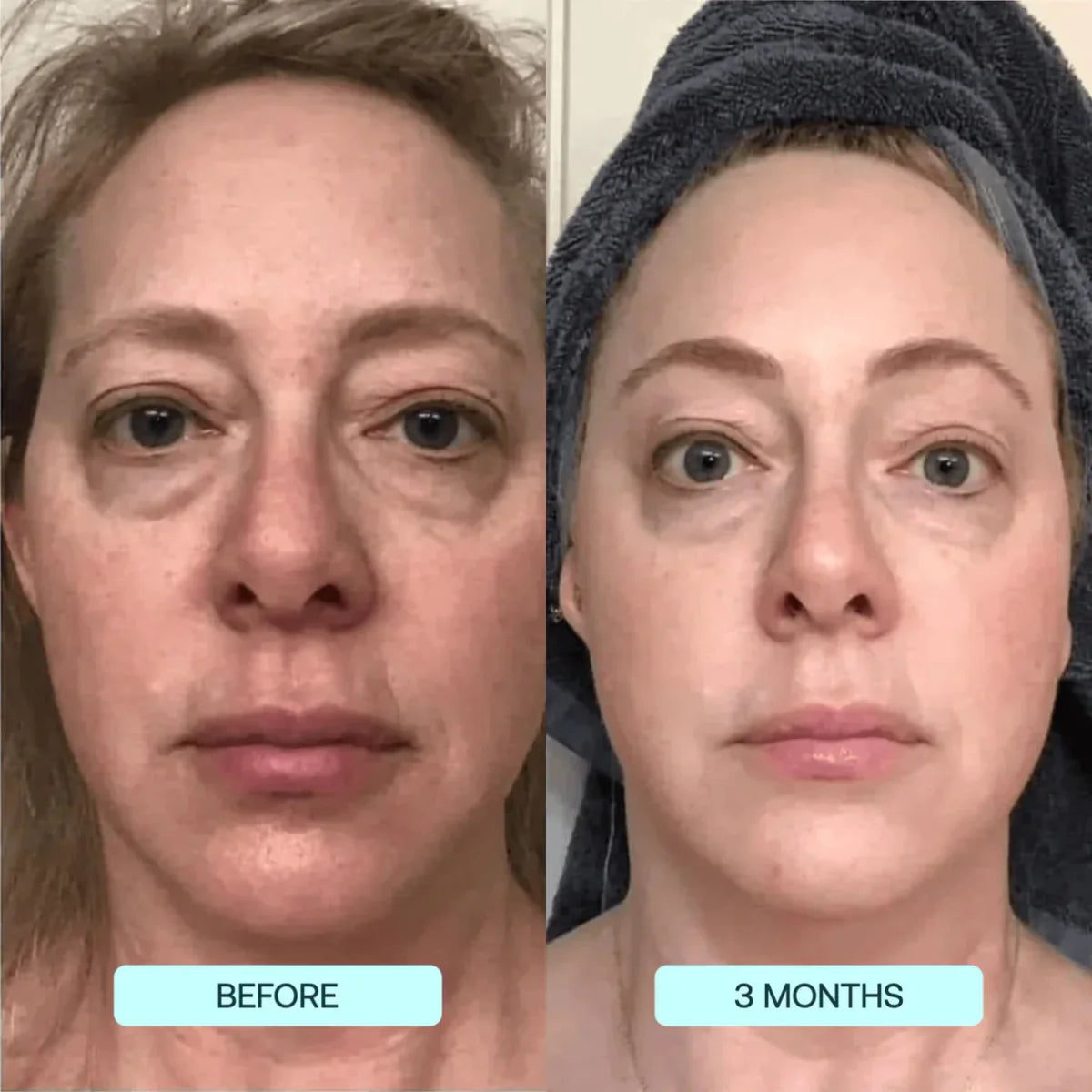 Zanzari Collageenfilms – NanoSkin™ Verstevigende Anti-Aging Boost
